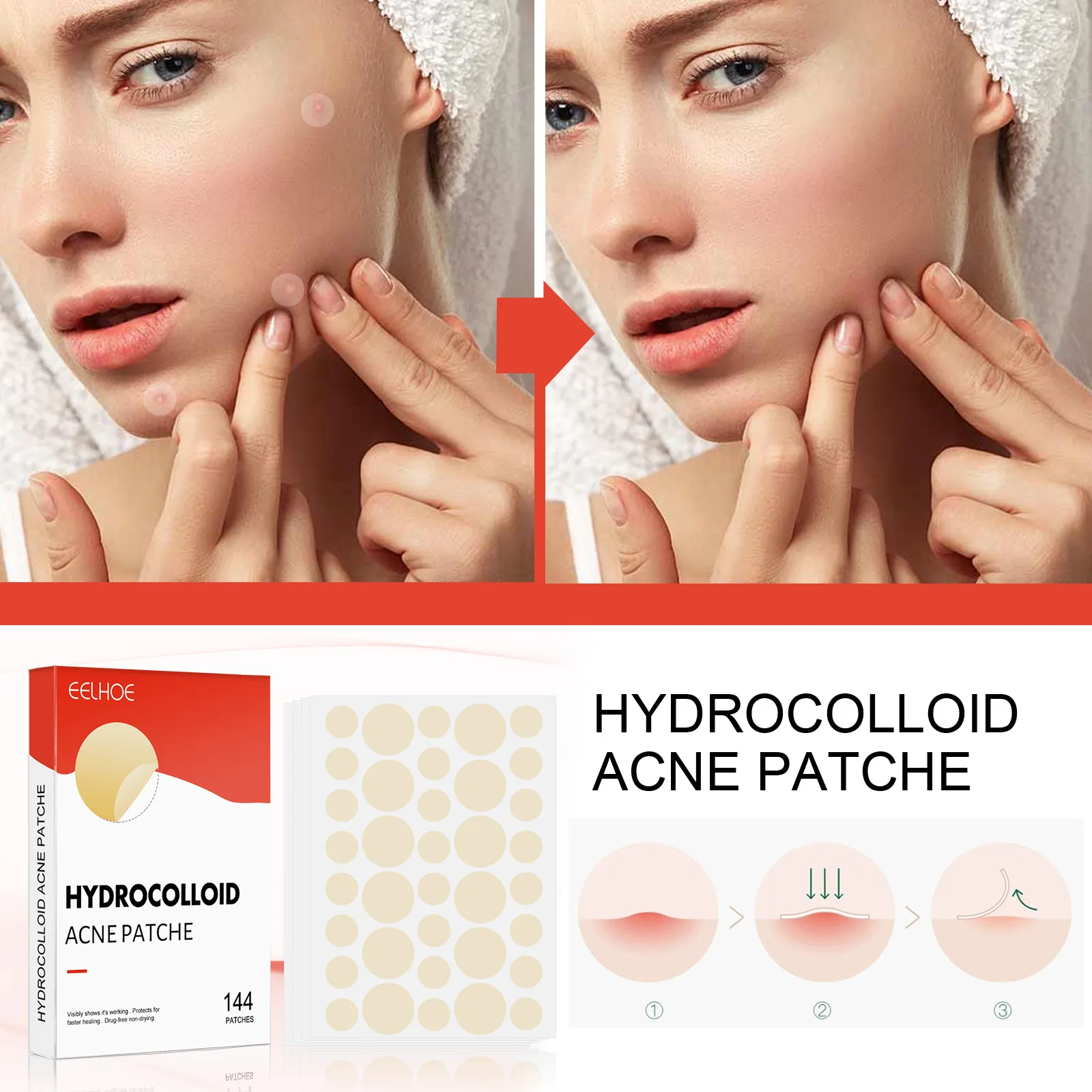 Onzichtbare Acne Patches Verwijderen Puistje Anti-Acne Hydrocolloïde Pleisters Vlekken Markeren Concealer Reparatie Sticker Waterdichte Huidverzorging