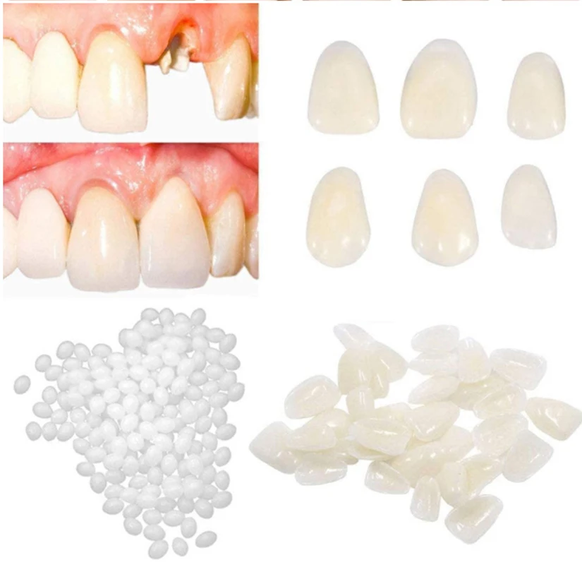 

Temporary Tooth Repairing Kit Moldable Resin False Teeth Gaps Solid Glue Denture Adhesive Tooth Whitening Beauty Tools