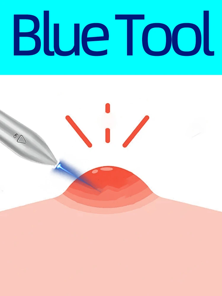 

2nd generation blue laser pointer