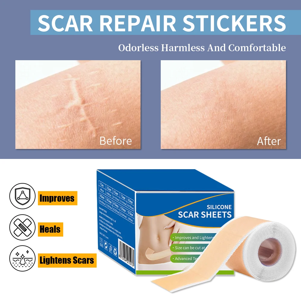 1 Roll Silicone Scar Sheets , 4cmX150cm Self-Adhesive Scar Cover Tape Reusable and Effective Skin Care Strips