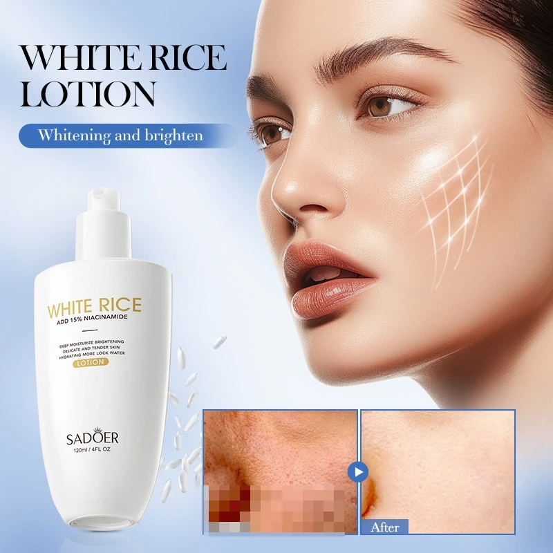 SADOER White Rice Niacinamide Moisturizing Lotion To Inhibit Dark Spot Improve Dark Yellow Skin Whitening Skin Care Products