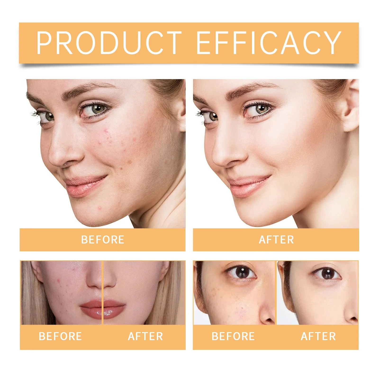 تونر مقشر بحمض الجليكوليك 7% 100 مل - محلول حب الشباب للعناية بالعشب وتقليل المسام وتفتيح البشرة وتقشير لطيف