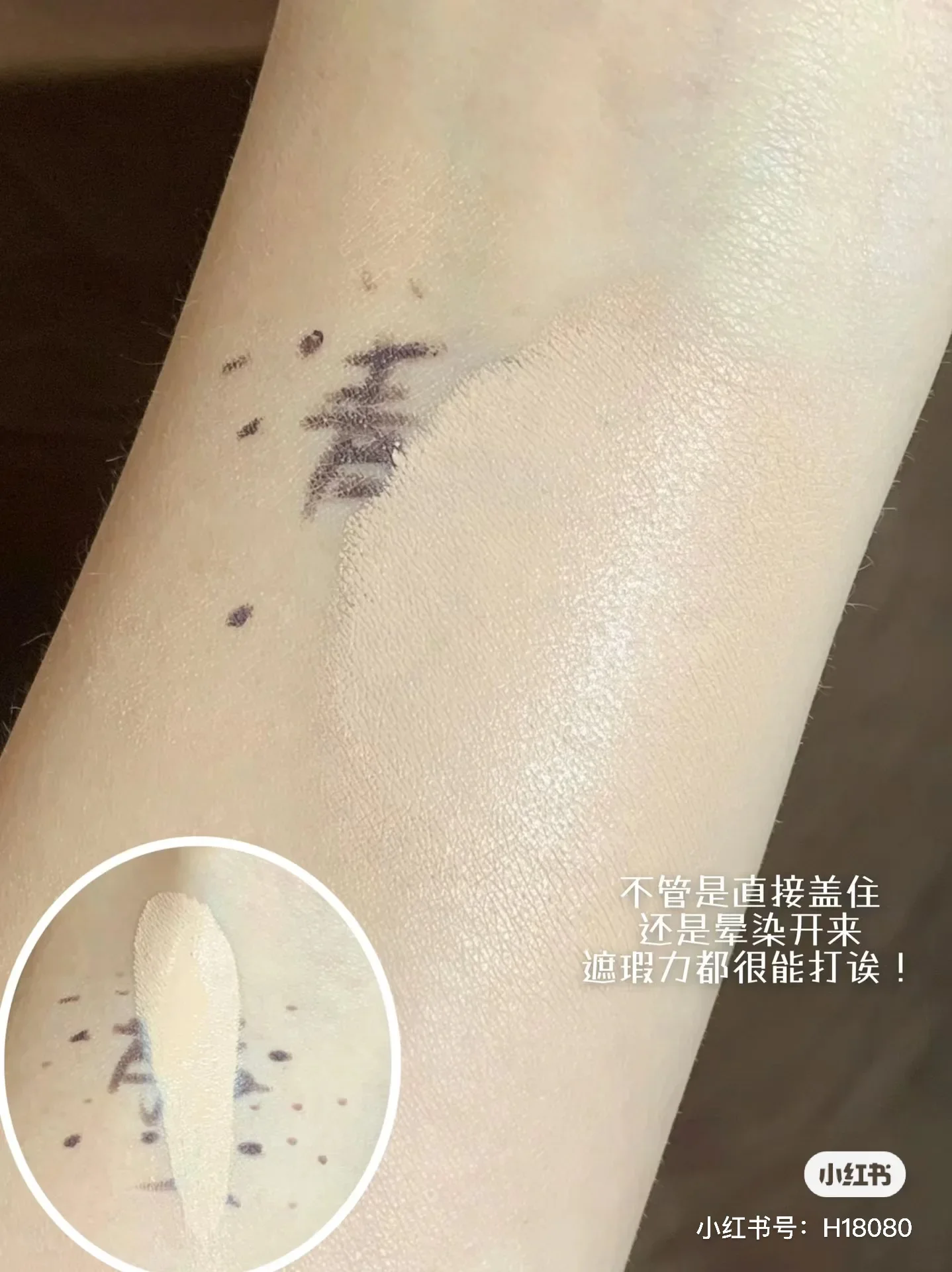 لوحة كونسيلر للوجه ريتشير، لونين، ترطيب، الهالات السوداء، العيوب، حب الشباب، الهالات السوداء، نسيج كريمي #4