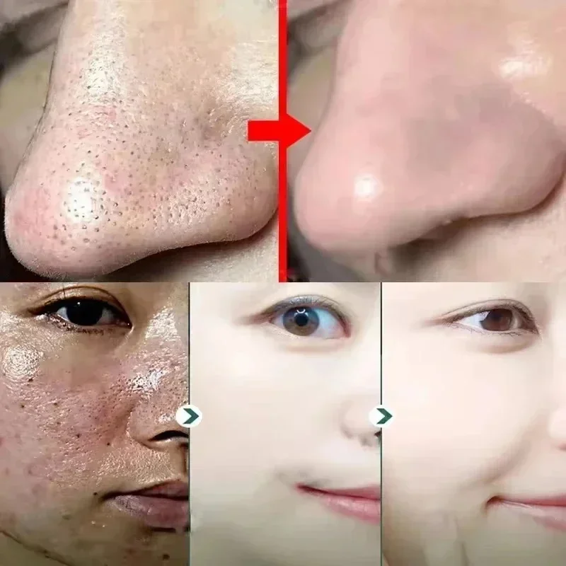 Salicylic Acid Pore Shrinking Mask Quick Elimination Large Pores Remove Blackehead Tighten Face Smooth Skin Korean Care Product