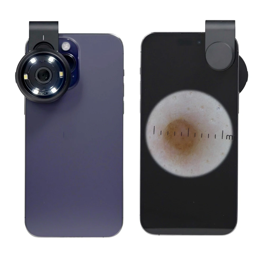 IBOOLO DE-300 Mobile Phone Dermascope Universal Polarized and Non-Polarized Light Optical Instrument for Medical Use
