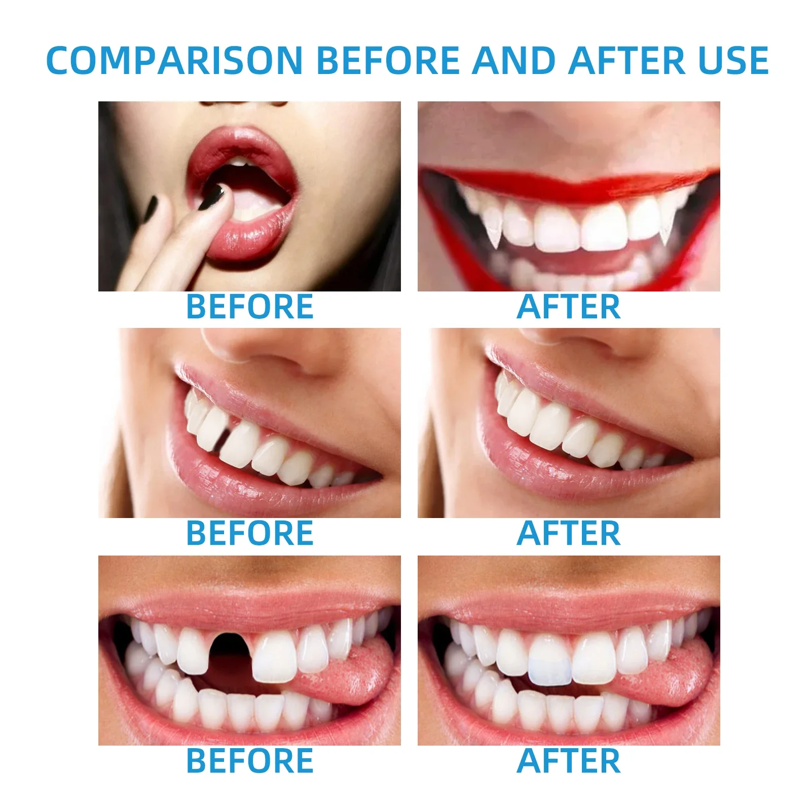 30g Resin Tooth Repair Glue Shapeable Teeth Gaps Filling Solid Glue Temporary Teeth Repair Falseteeth Glue Safety Dental Supplie