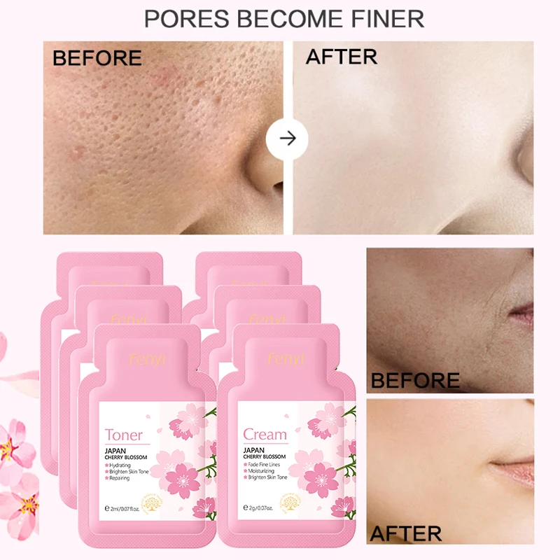 

Japan Sakura Face Cream Toner Set Brighten Skin Tone Fade Fine Lines Moisturizing Hydrating Repairing Anti-wrinkle Facial Cream