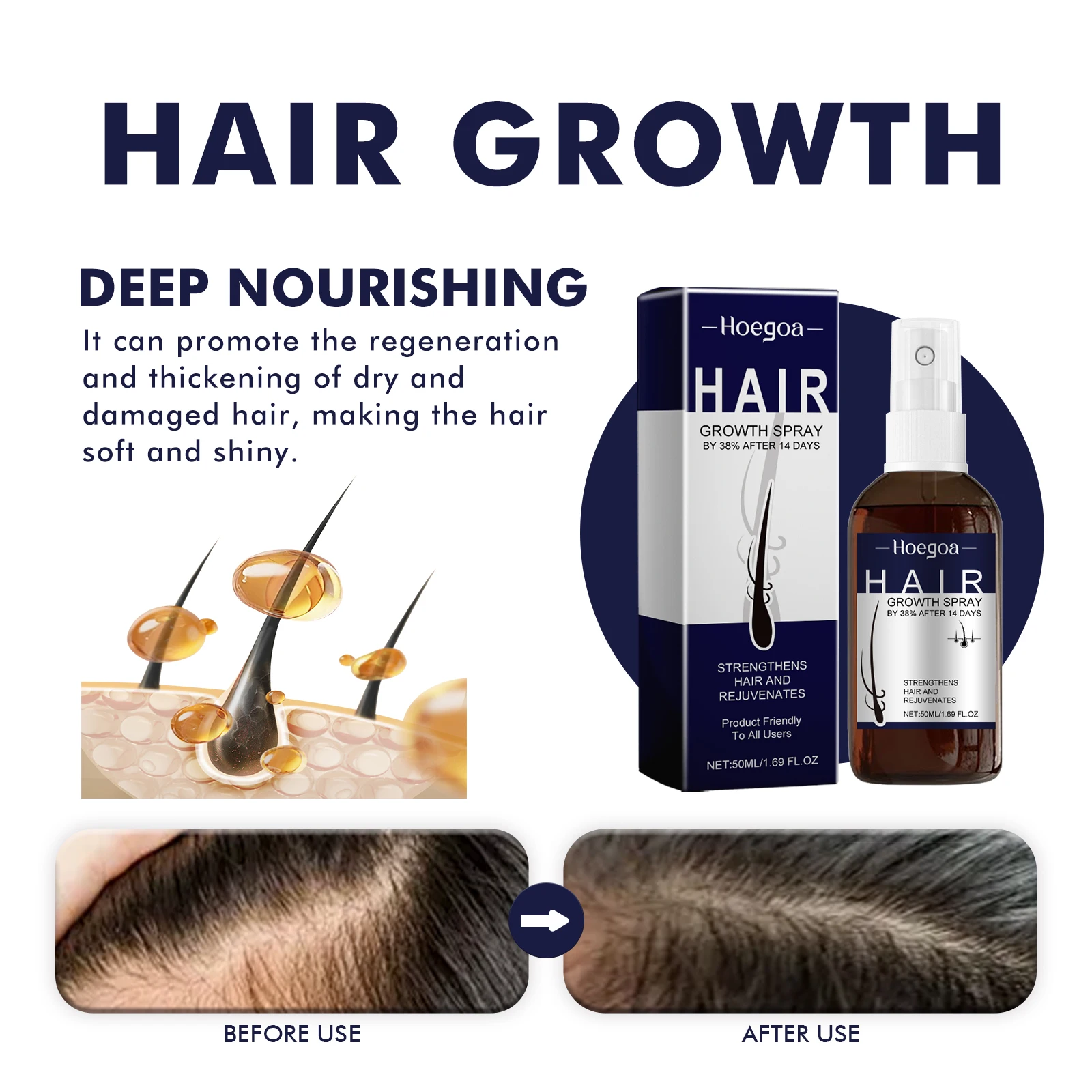 Haargroei Spray Voorkomen Kaal - Hair Scalp Massager recensie en prijs