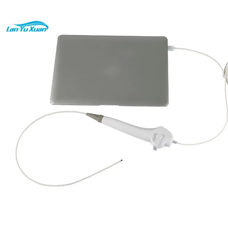 ENT endoscope BESDATA Wholesale Price USB ENT medical Endoscope c.amera for ear nose throat