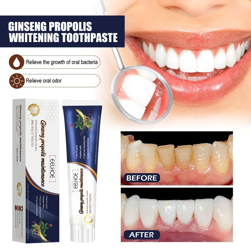 Ginseng Propolis Whitening Toothpaste Cleansing Yellow Tooth Tartar Stains Remove Oral Odor Hyun White Solid Teeth Gum Care