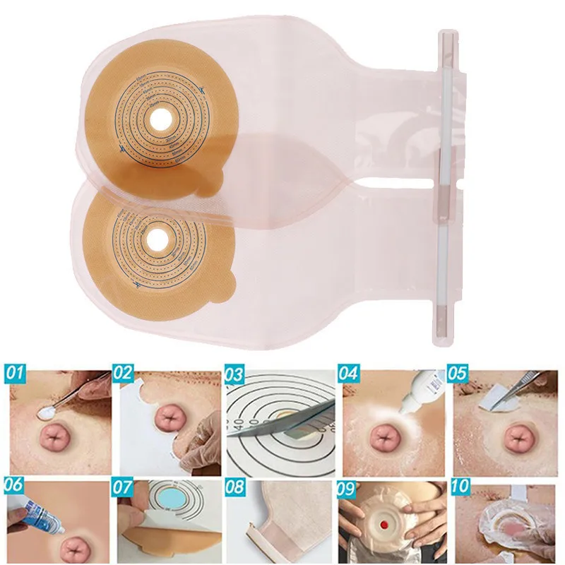 10Pcs One-piece Colostomy Bag Open Seal Strip Design Stool Ostomy Care Bag Cut Size 20-60mm