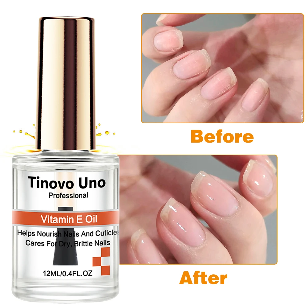 Tinovo น้ำมันบำรุงหนังกำพร้าวิตามินอีน้ำมันบำรุงเล็บให้ความชุ่มชื้นนุ่มทำให้เล็บแข็งแรงซ่อมแซมเล็บที่เสียหาย