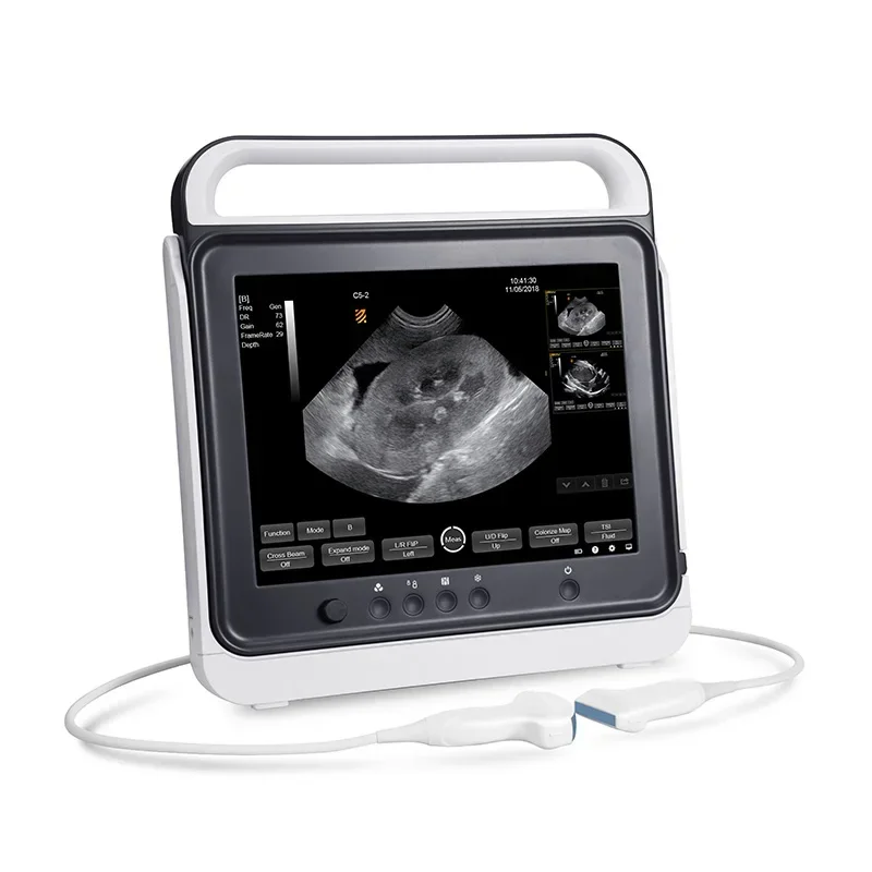 Veterinary Touch Screen Portable Ultrasound Scanner,black & White Ultrasound Machine Price