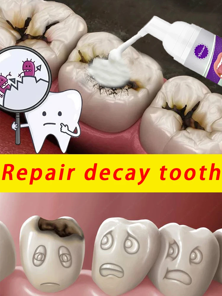 Caries tratamiento reparación de dientes encías