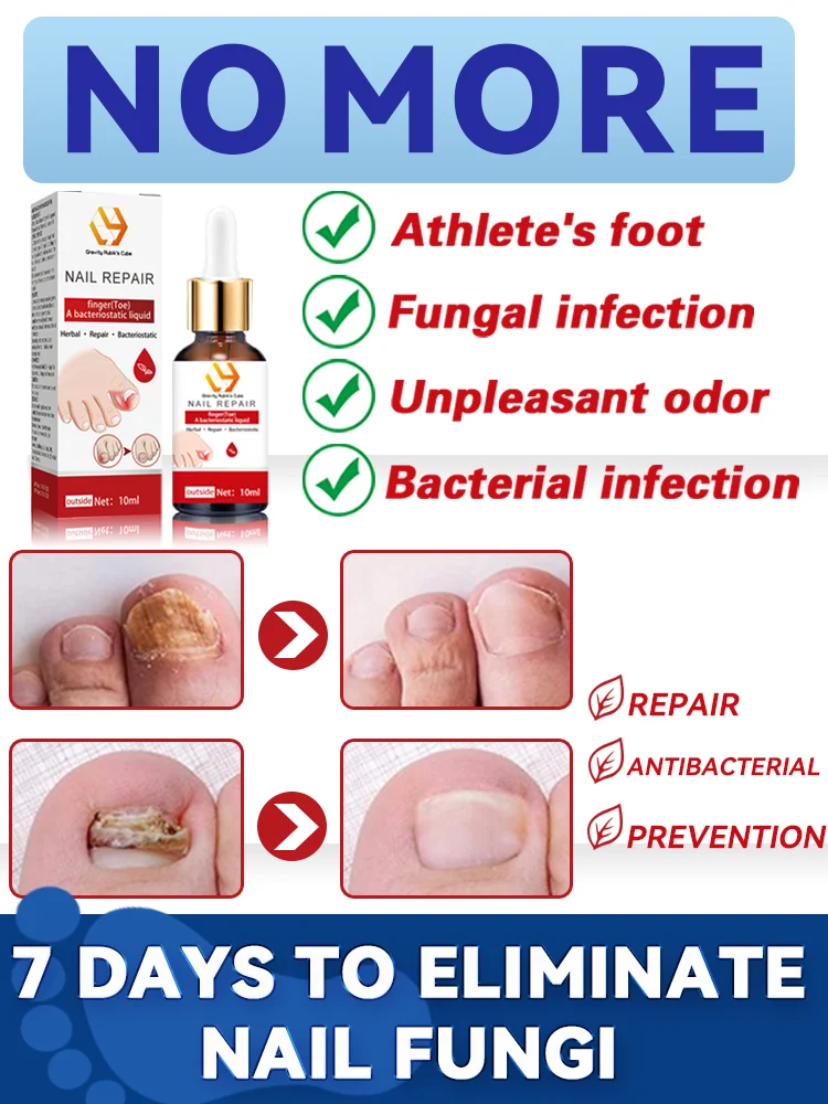 Foot Nail troubles Solved completely