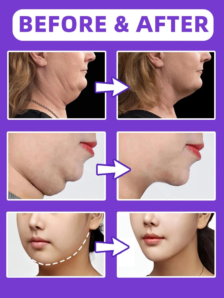 Slimming Face Cream V-Shape Double Chin Fat.