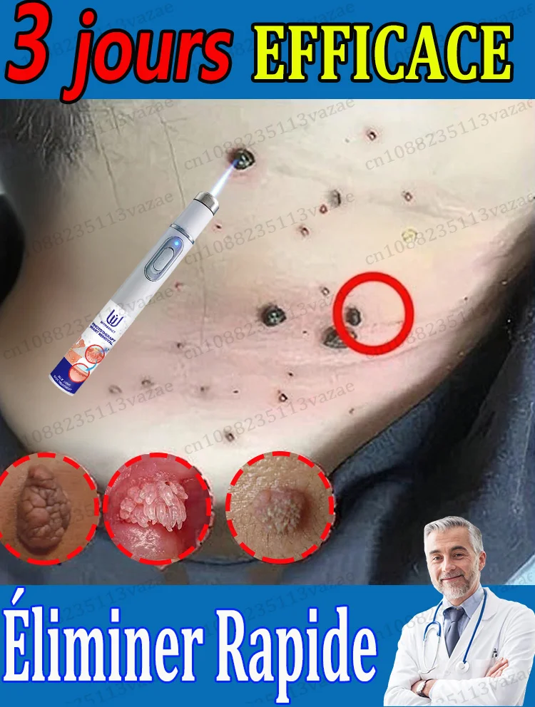 

Удаление грязи из вашего тела