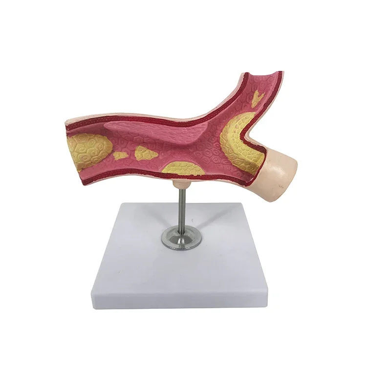 PVC arterial sectional anatomy model trained in medical school
