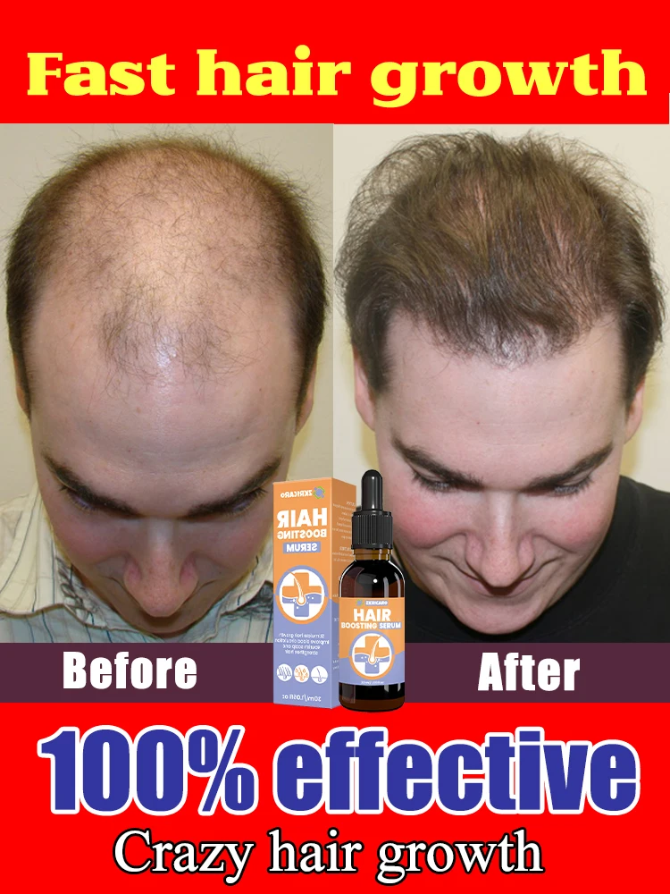 Hot sale, more hair. Say goodbye to baldness, the secret to thick hair,Grow hair anywhere.