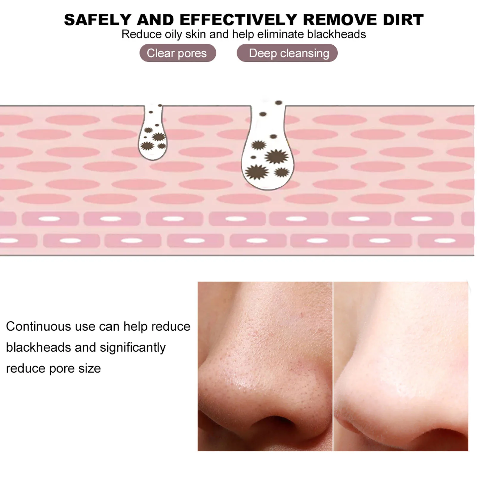 黒ずみ除去マスク 鼻毛穴クレンジングストリップ 黒ずみピールオフフェイシャルマスク 黒ずみ除去 鼻毛穴クレンジングストリップ