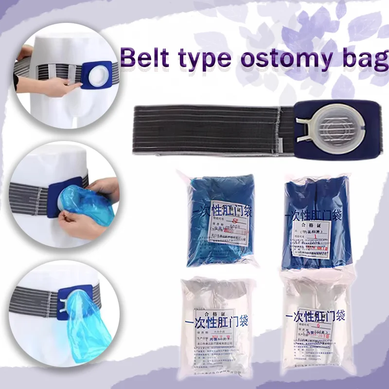 Colostomy Bag for Colorectal Cancer Patients with Diversion Ostomy: Artificial Ostomy, Stool Management, Anal Sleeve, Disposable