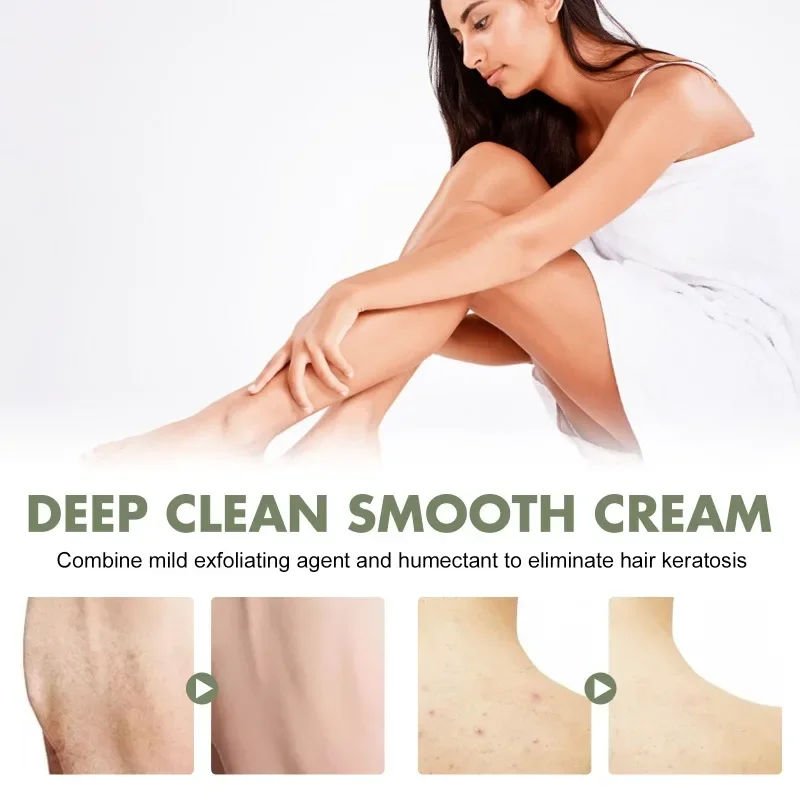 Deep clean smooth cream moisturizing improve Dark spots exfoliation controls oil remove acne whitening body skin repair Gel