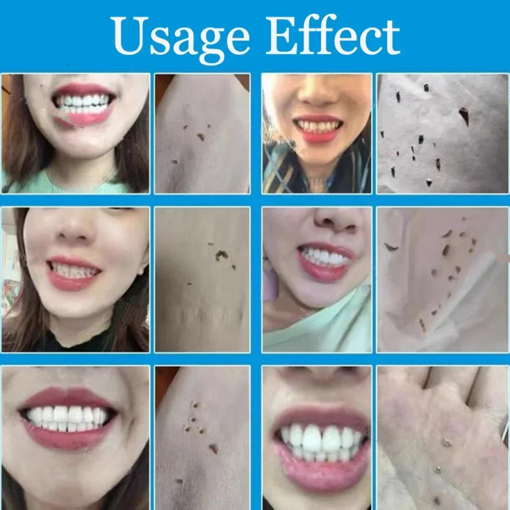 مزيل حساب التفاضل والتكامل الأسنان تبييض الأسنان رذاذ معجون الأسنان تنظيف نظافة الفم إزالة الكريهة البلاك البقع العناية بالنفس الطازج