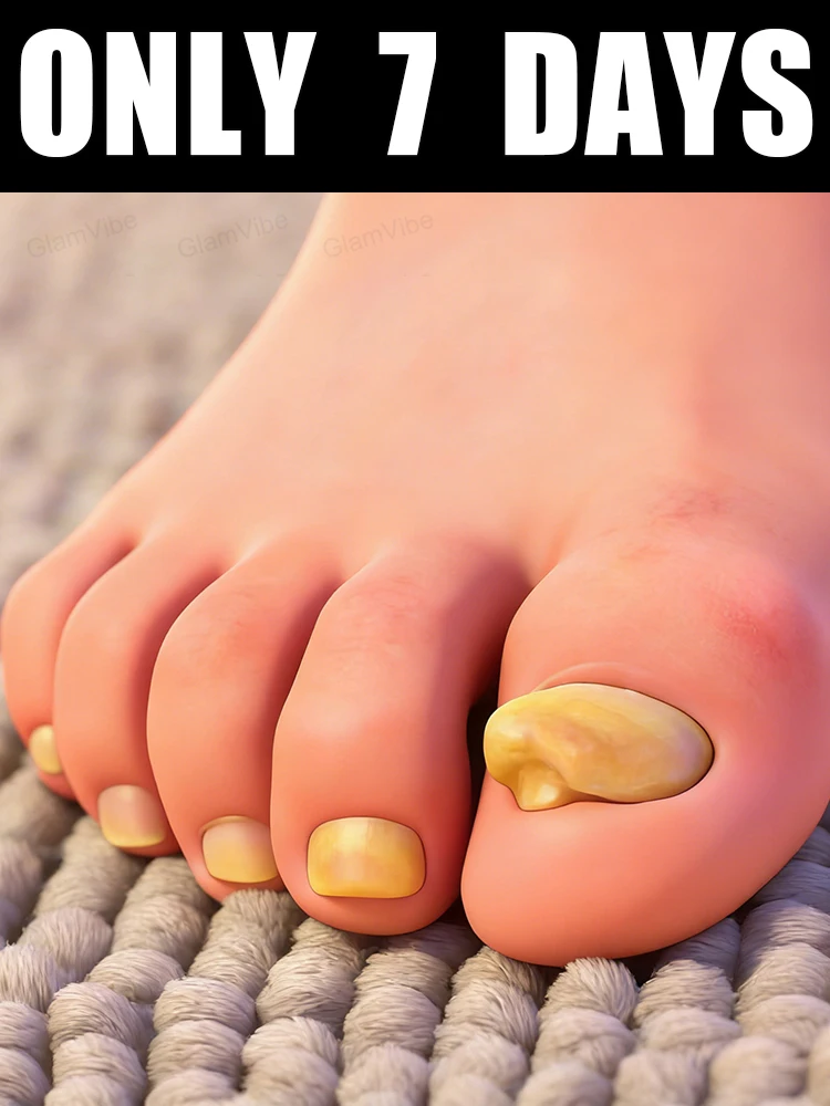 New 2026 Offer! Free Shipping! Tea Tree Nail Solution 10ml