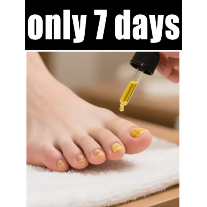 

manicure for bad Can in 7 days farewell