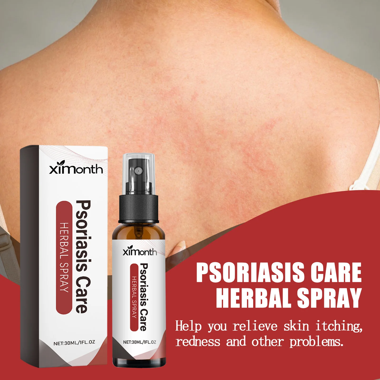 Рисунок 4 - Спрей снимает зуд