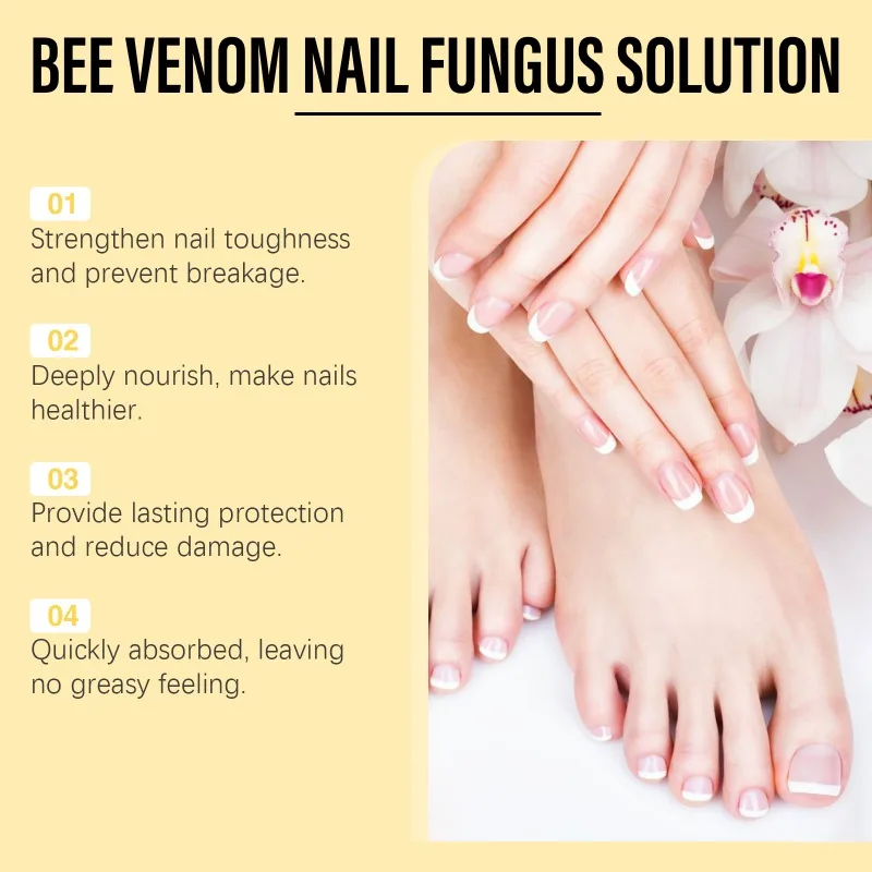 Solución de hongos en las uñas con veneno de abeja, cuidado de las manos y los pies, espesamiento de las uñas de los pies, esencia amarillenta, uñas encarnadas, producto de reparación de uñas gris brillante