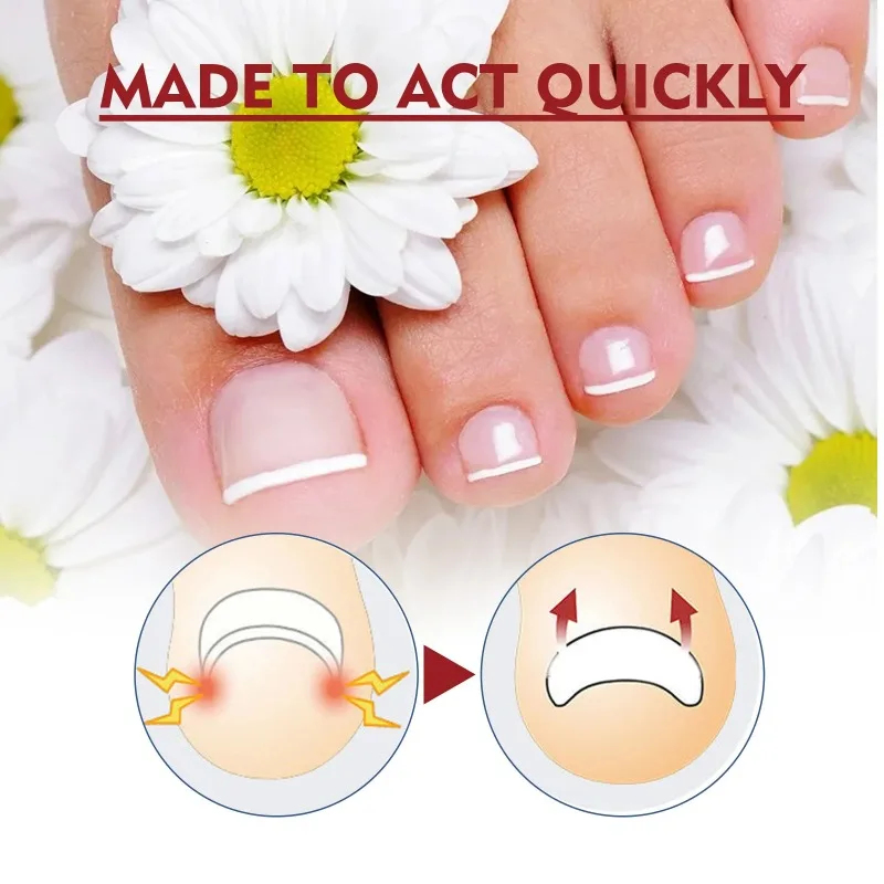 10ML Anti Paronychia Relief Oil Repair Nail Inlay Thickening Nail Polish Brightening Gray Nail Polish Groove Care Oil