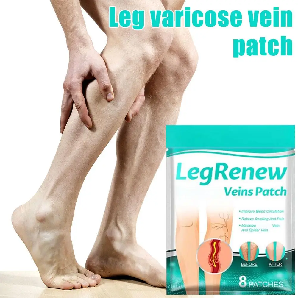 

Varicose Vein Patchs Promote Metabolism Promote Smooth Blood Circulation Care Patch Sore Swelling Legs Sore Swelling Plaster
