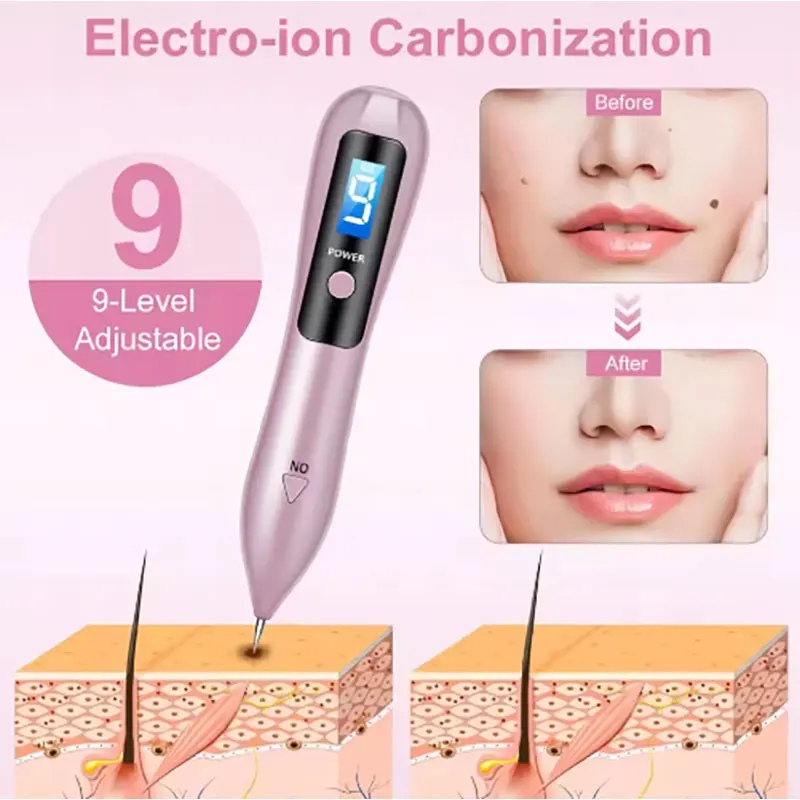 Laser Plasma Pen for Skin Tag Remover Freckle Black Dot Papilloma Warts Mole Pimples Tattoo Removal Laser Pen Beauty Care Tools