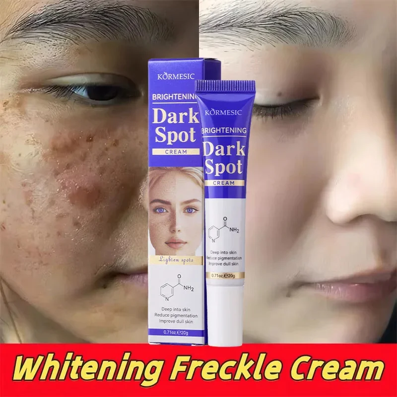 

Brightening Spot Cream Niacinamide Reduce Chloasma Melasma Melanin Fade Fine Lines Fade Dark Spot Dulless Moisturising Face Care