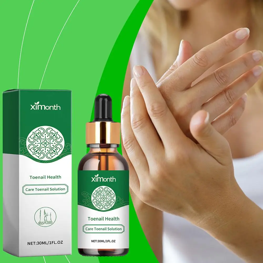 Sérum de traitement des champignons des ongles, Parker, réparation fongique, anti onychomycose, paronyamitié, gel de soin des mains, produits pour l'élimination des infections, 30ml, Q9esee