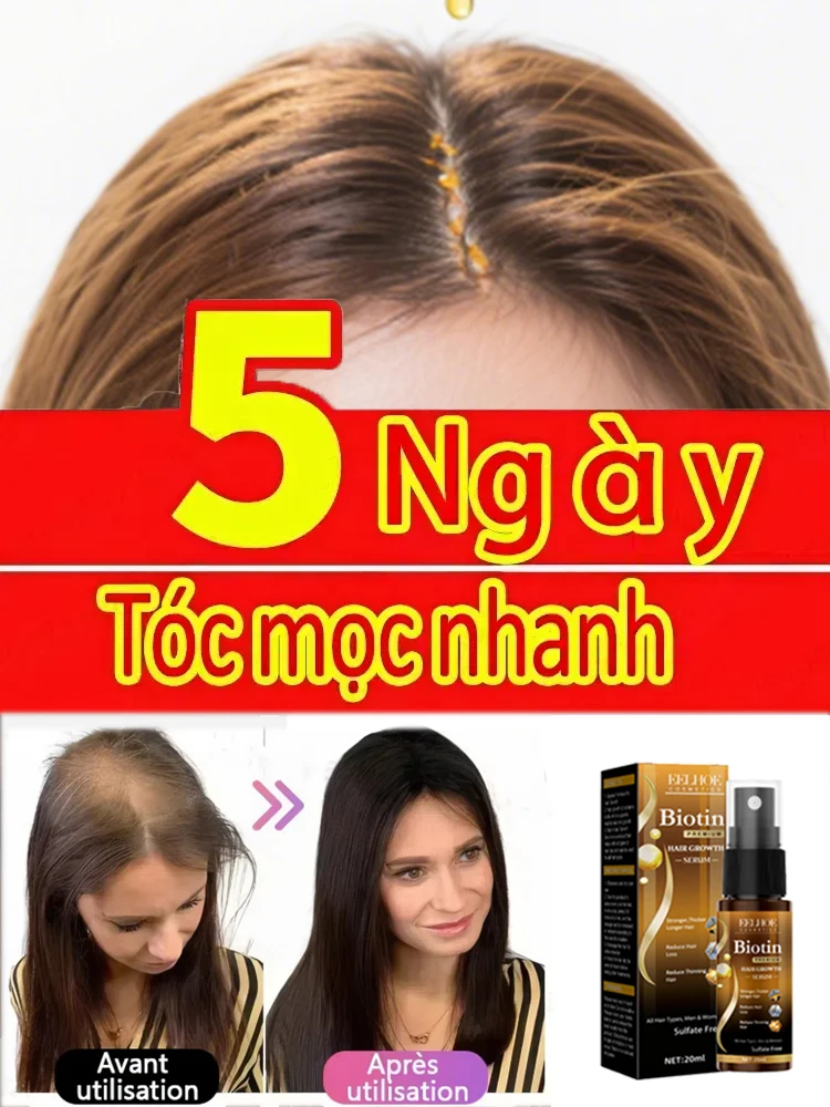 

Hair growth and anti hair loss serum, anti hair loss scalp nutrition products