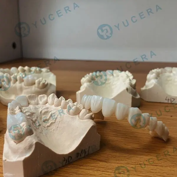 YUCERA Dental  Zirconia Multilayer Block 4D Pro Multilayer 8 Layers Gradient Color and Strength Long Bridge for Dental Lab