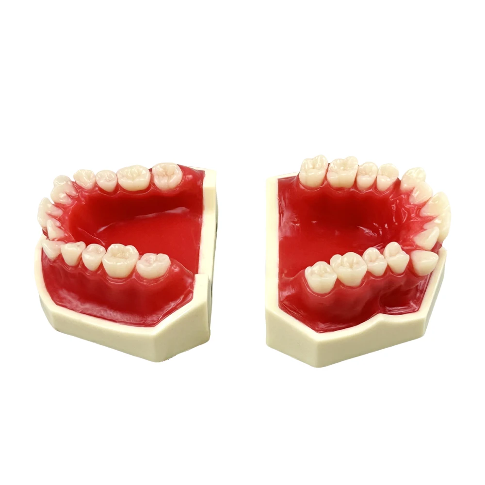 Dental Orthodontic Practice Model Red Wax Gum Malocclusion Model Typodont For Dentistry Teaching Accessories Educational Tools