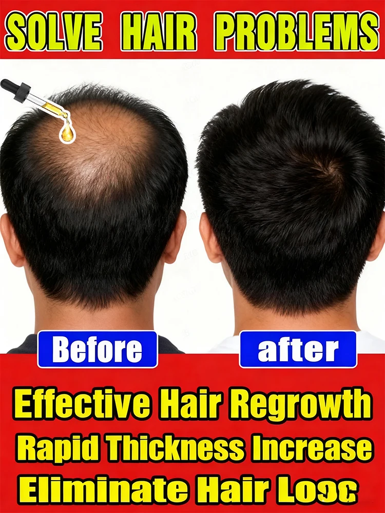 Target hair loss at the root: Our premium hair growth oil stimulates circulation, repairs damage, and delivers visible volume in