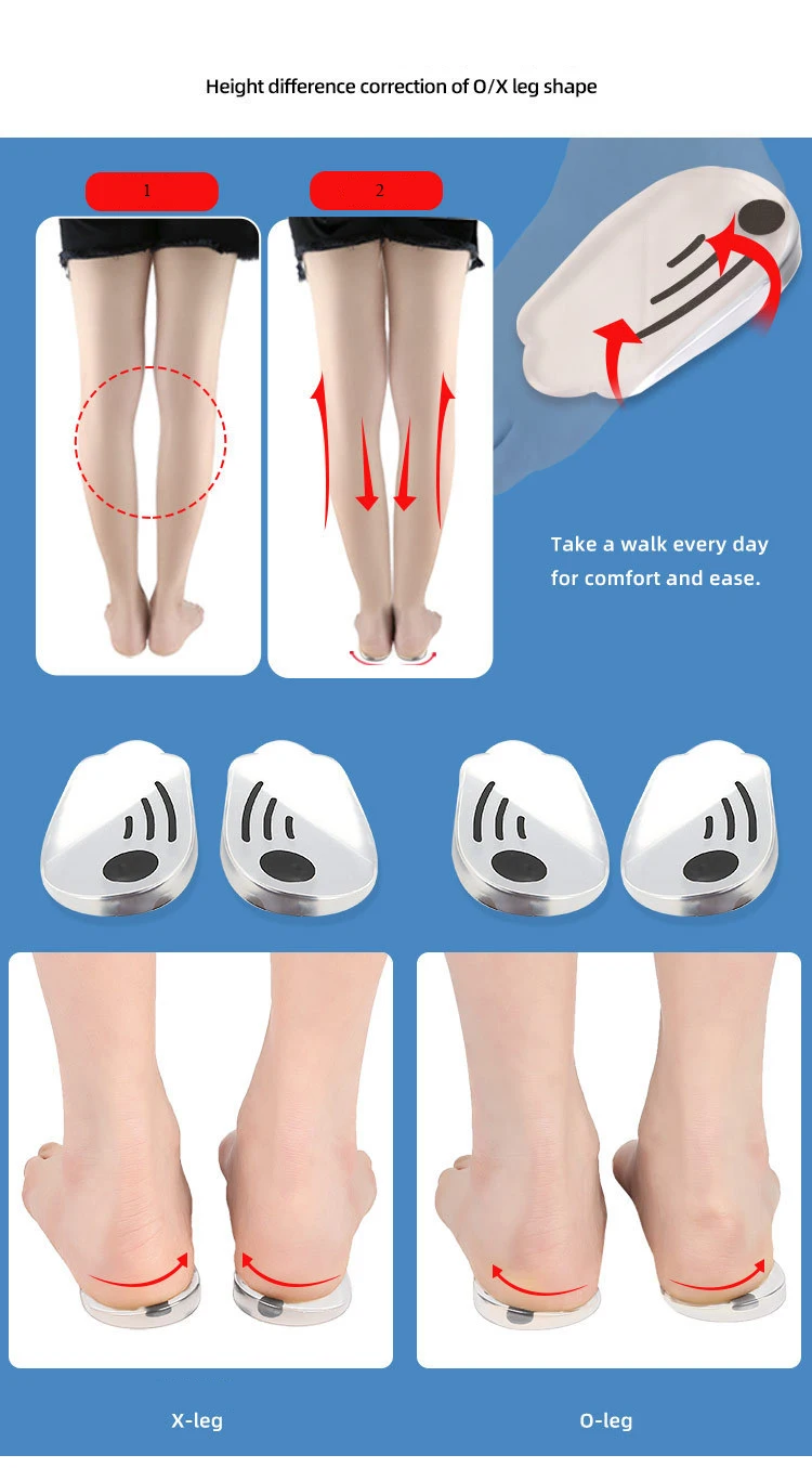 1/5 Paar O/X Beintyp Valgus Korrektur Männer Frauen Silikon Gel Schuhe Einlegesohle Orthopädische Einlegesohlen für Füße Magnet Massage Schuh Pads – Detail 3