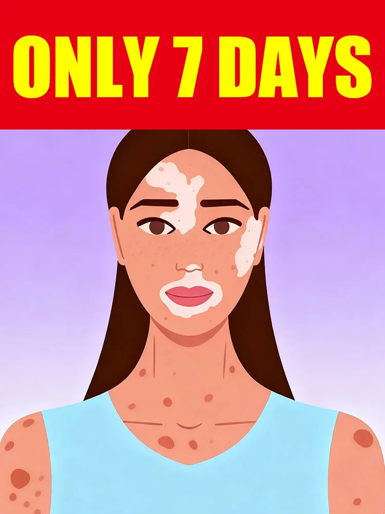 Blue Laser Says Goodbye To Vitiligo