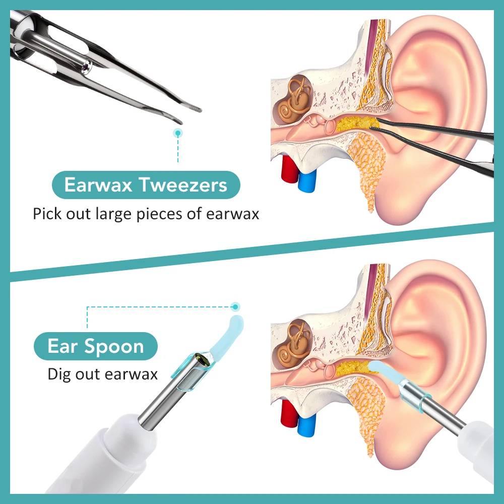 Smart Visual Ear Wax Cleaner with Camera HD1080P 3.5MM WIFI Ear Pick Endoscope Earwax Removal Ear Cleaning Tool with 6 LED Light
