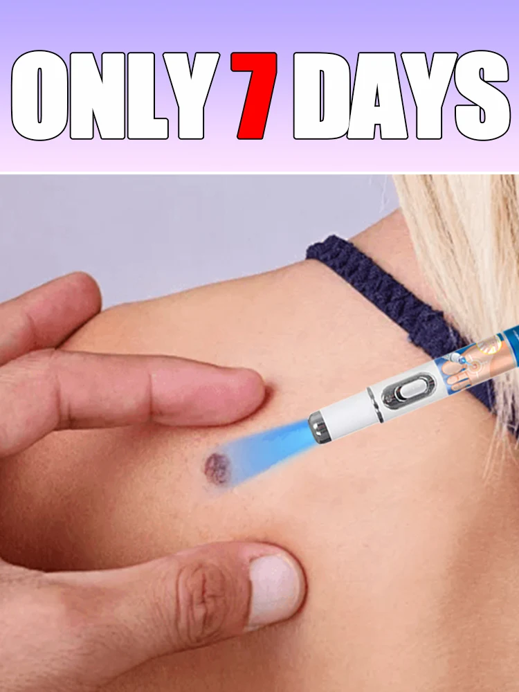 2025 hot sale ᵍᵉⁿᵉʳᵃᵗⁱᵒⁿ ᵘᵖᵍʳᵃᵈᵉᵈ wᵃʳᵗ ⸴ ʳᵉpᵃⁱʳ wᵃʳᵗˢ ʳᵒoᵗ ⸴ ᑫᵘⁱᶜᵏˡʸ