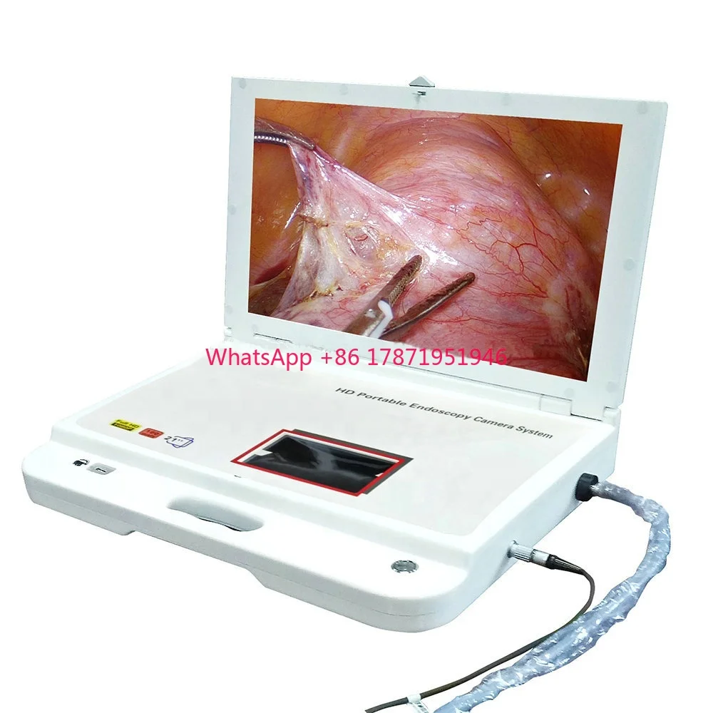 

Portable surgical medical endoscopic camera system for laparoscopic laparoscopy ent arthroscopic arthroscopy