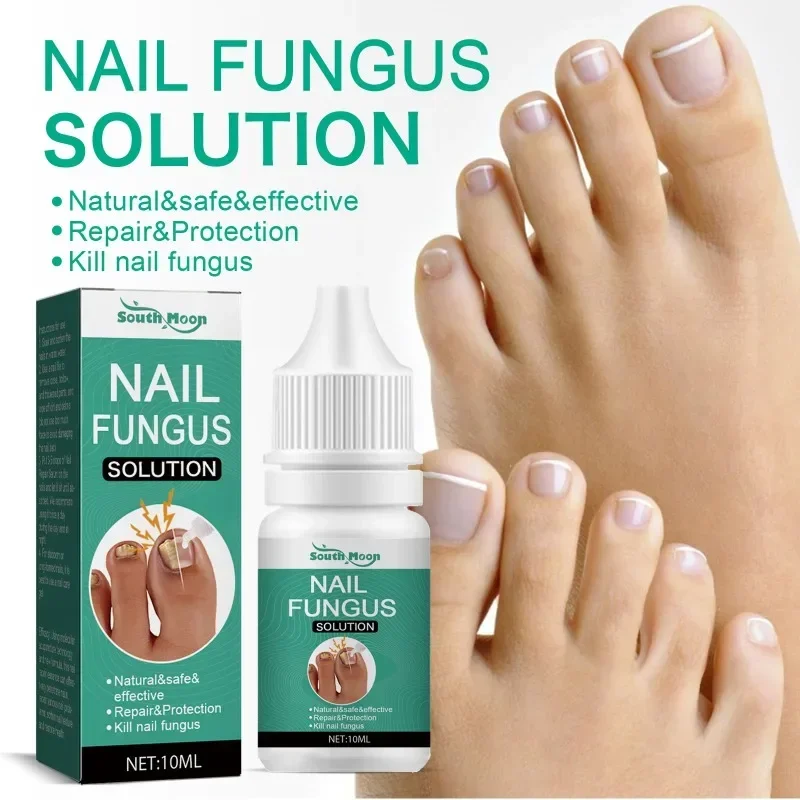 Nail Care Facial Essence Hand and Foot Care Toenail Thickening and Yellowing Care Essence Ingrown Nail Gray Nail Repair