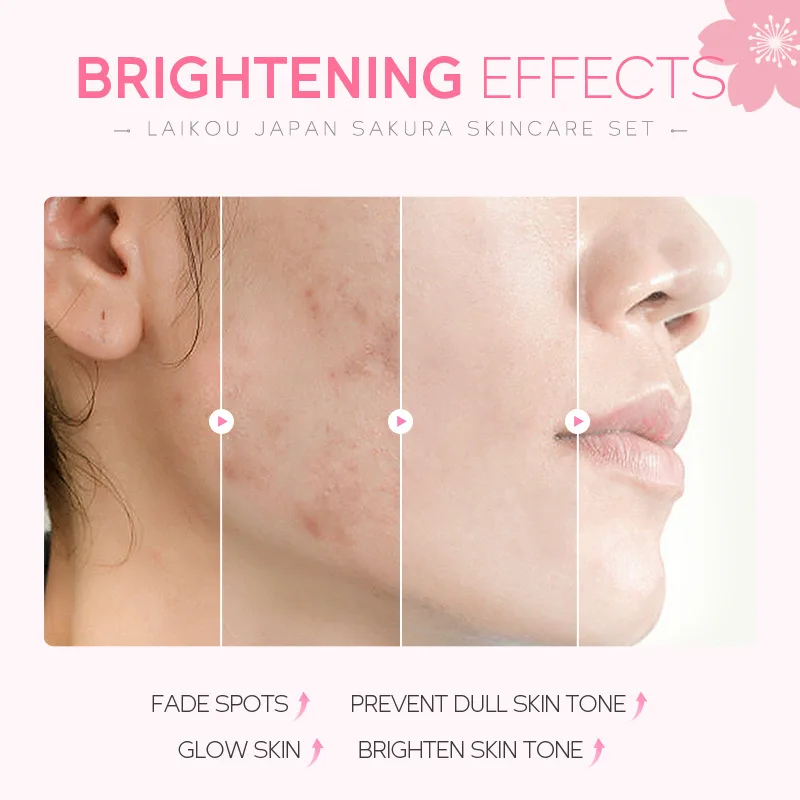 Sakura Skin Care Sets Face Cream Eye Cream Facial Cleanser Reduce Acne Blackhead Korean Cosmetics Face Care Eyes Care Skincare
