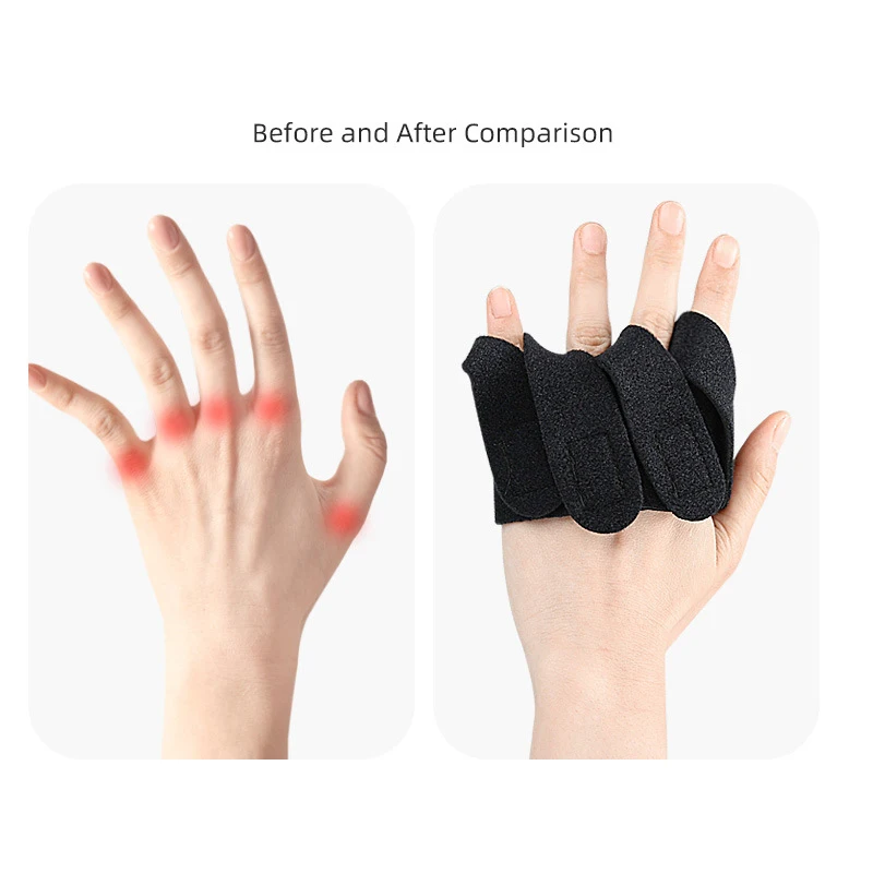 1Pairs Adjustable Pain Relief Finger Splint First Aid Finger Fixing Tape Brace Sleeve Protector Corrector Sports Support Bandage