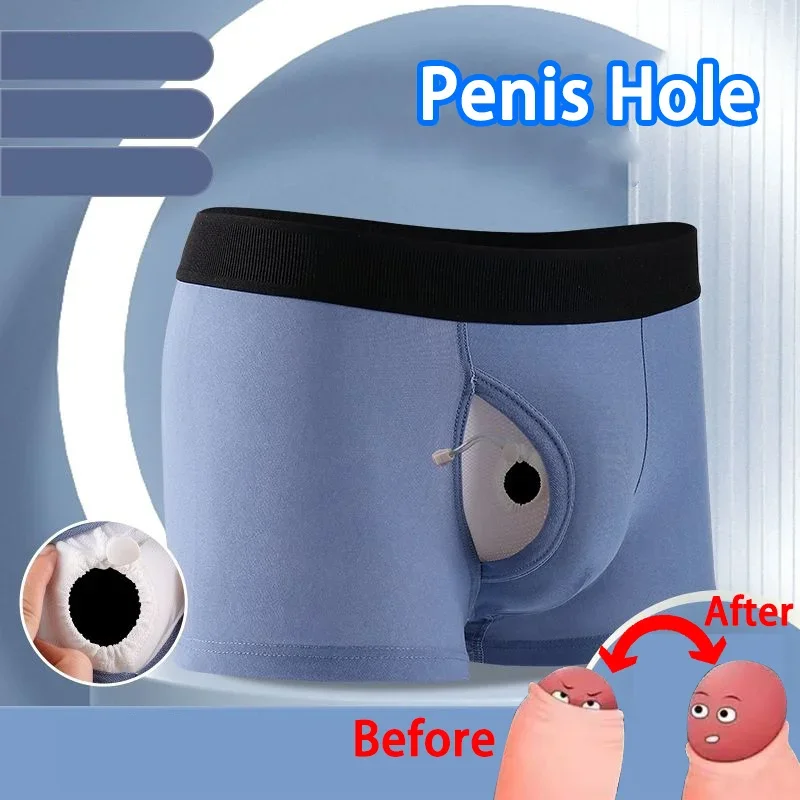 Man Front Open Pouch Underwear Penis Boxers Foreskin Enhancing Sexy Bulge Lingerie Health Care Glan Expose Hole Sheath Underpant