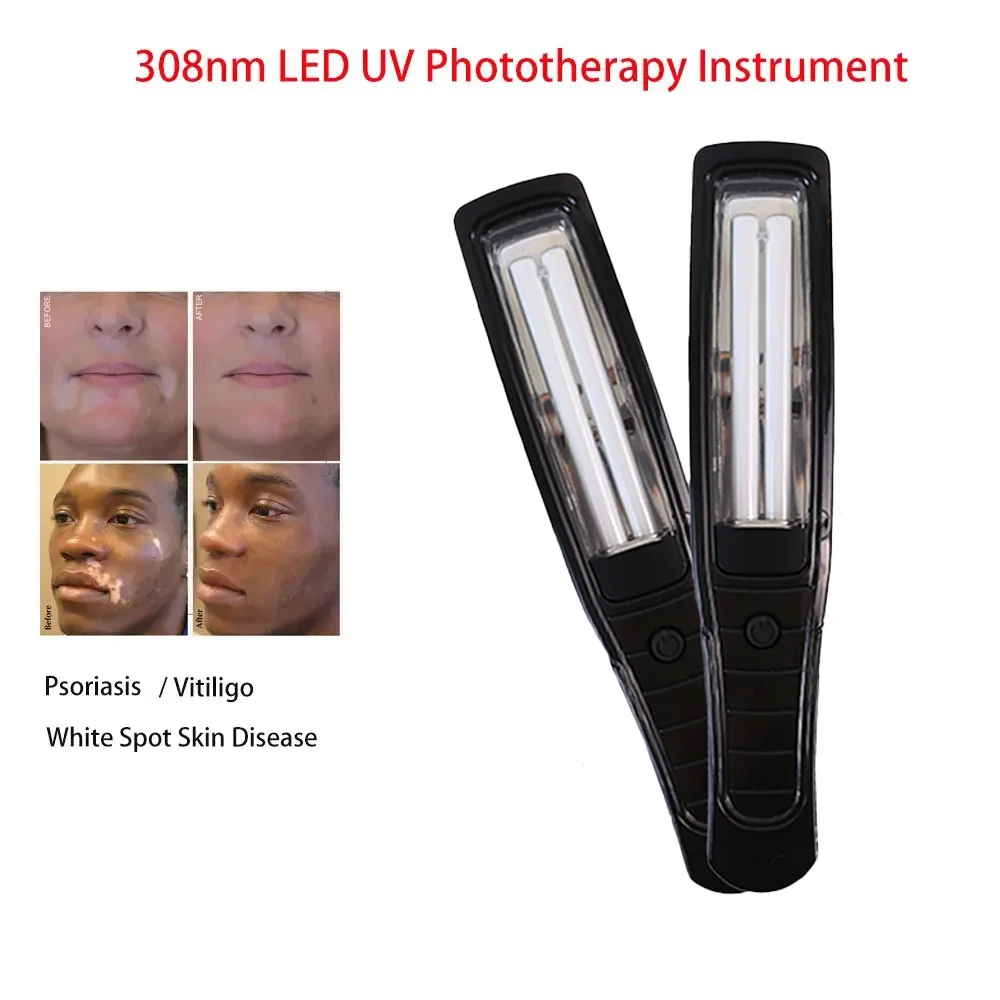 

UVB 311NM Narrowband Ultraviolet Lamp Phototherapy Instrument Laser Treatment Anti Vitiligo Psoriasis White Spot Skin